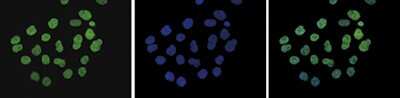 Immunocytochemistry/ Immunofluorescence: Histone H3 [Dimethyl Lys9] Antibody [NBP2-59200]
